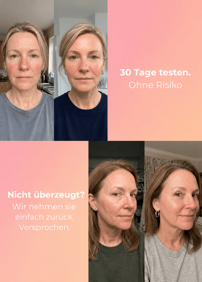 Hautbild nach 4 Wochen Leafy Anti-Aging Creme – glattere Haut mit 100% Geld-zurück-Garantie